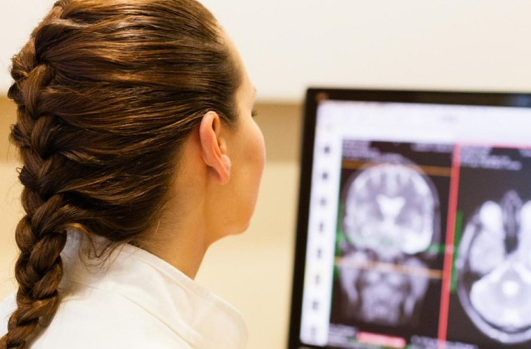 Idrogel sviluppato per il trattamento degli aneurismi
