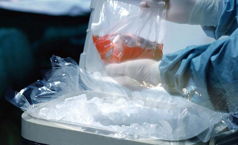 Nova tecnologia muda o tipo sanguíneo de um órgão doador para um universal