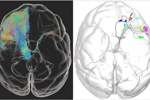 L'intelligenza artificiale aiuta gli scienziati cinesi a creare una mappa da 1 micron del cervello di una scimmia