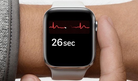 Apple Watch는 혈압과 체온을 측정하는 법을 배웁니다.