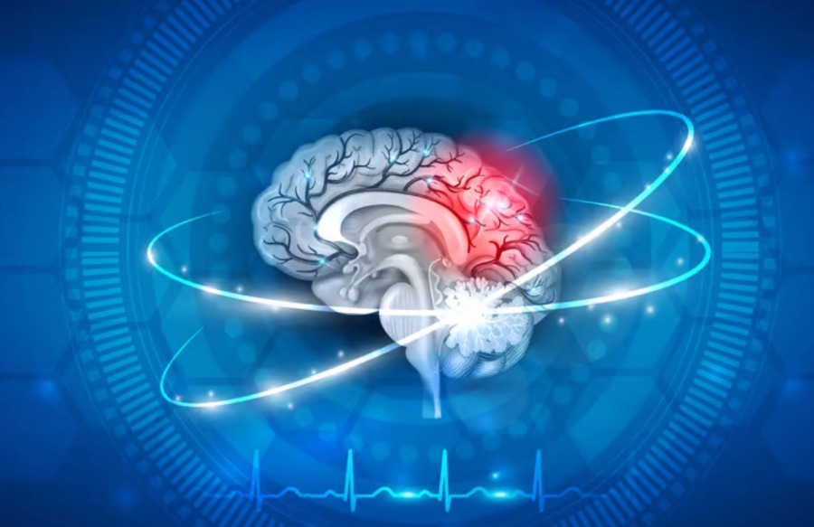 Um risco aumentado de acidente vascular cerebral em adultos está associado a um determinado tipo de sangue.