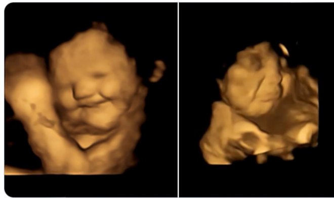 Babys im Mutterleib schmecken die Nahrung, die ihre Mutter isst.