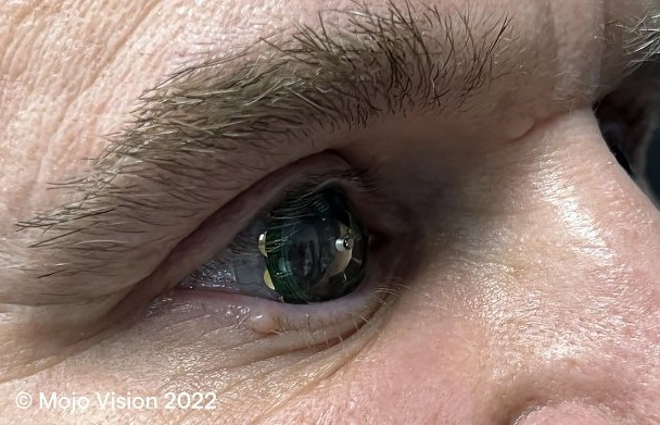 Mojo Vision, 증강 현실 콘택트 렌즈 개발