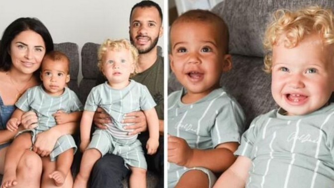 Des jumeaux sont nés en Angleterre avec des yeux et des couleurs de peau différents